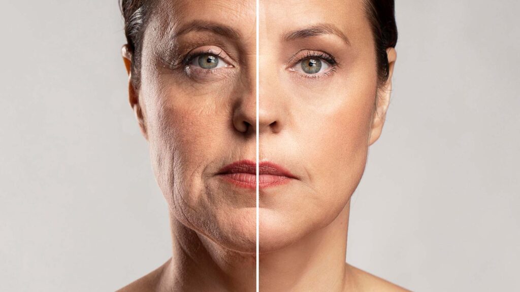rejuvenecimiento facial sin cirugía en cancun basado en ciencia