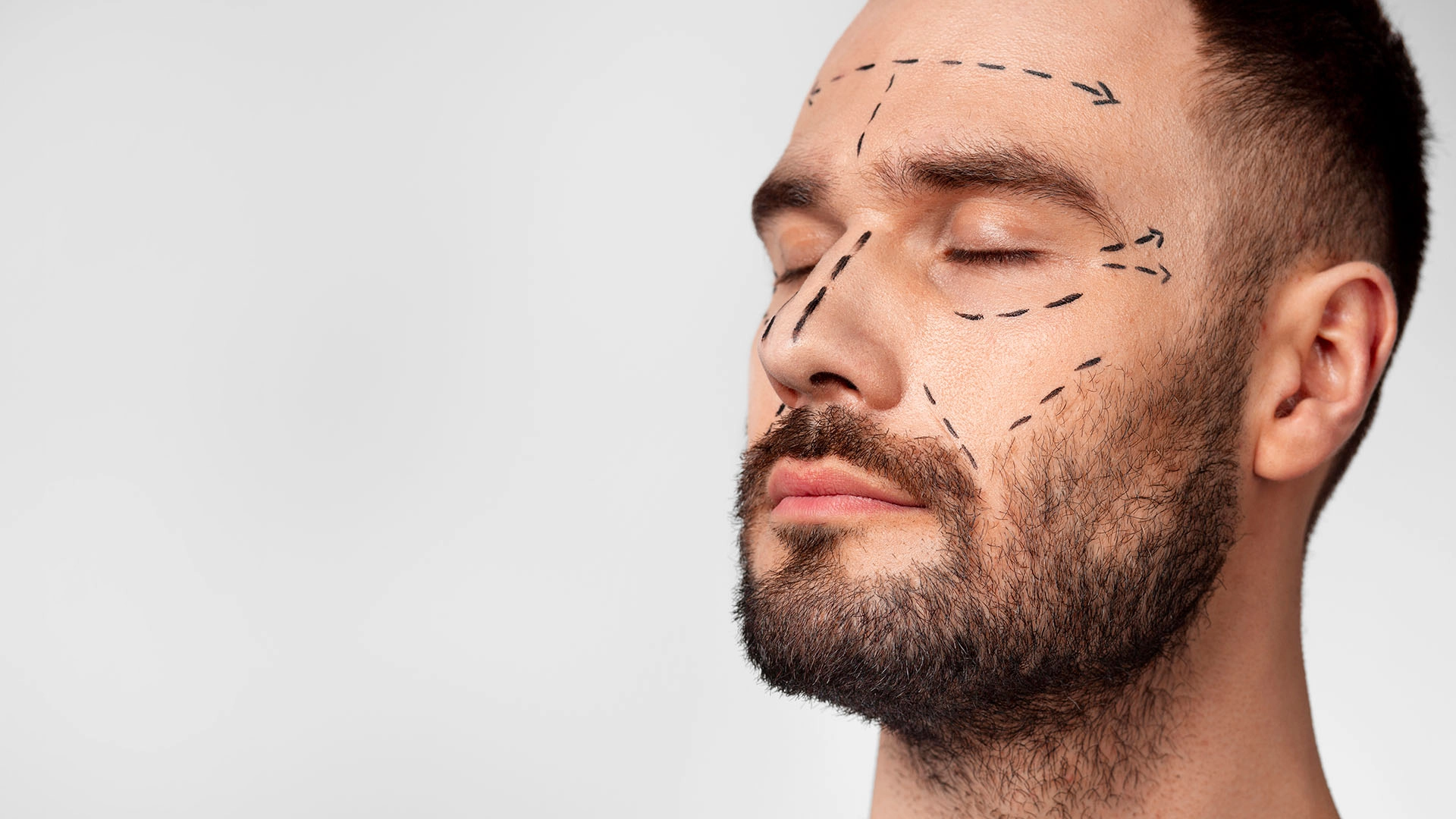 El costo de una rinoplastia para hombres