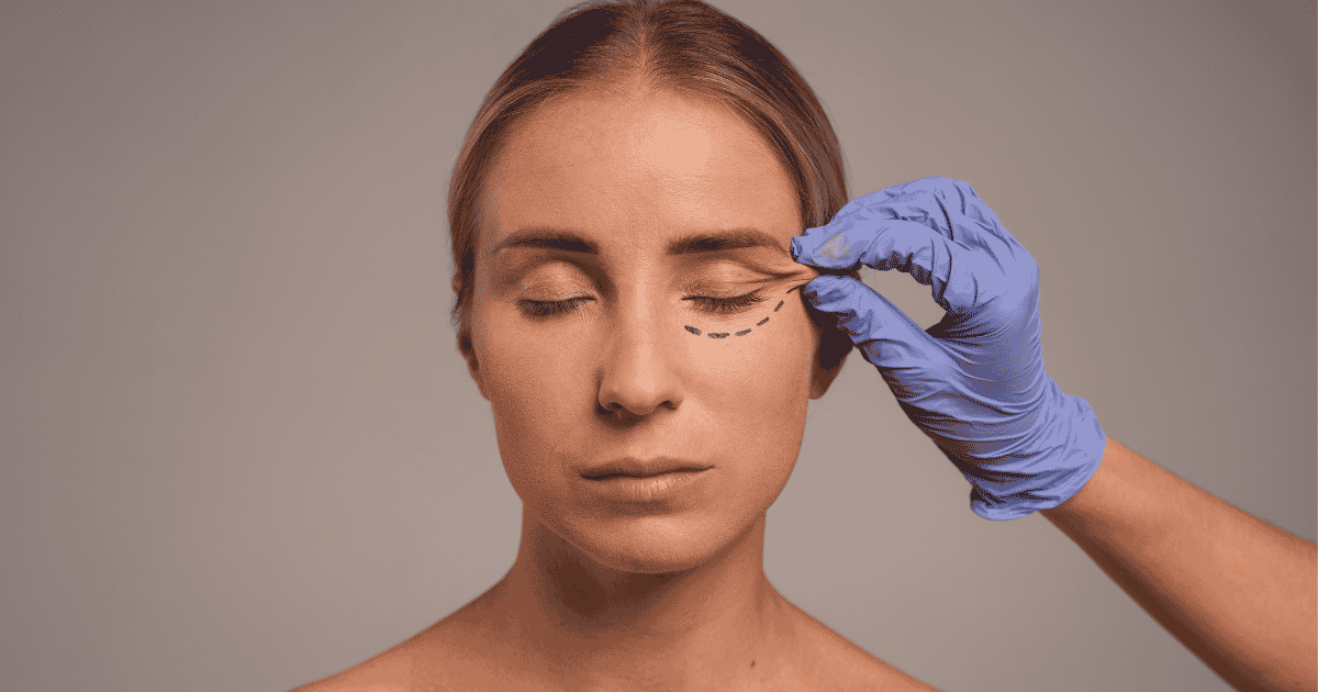 Blefaroplastia es, sin duda, la cirugía que más cambia la forma en que el mundo te percibe en Cancún, México