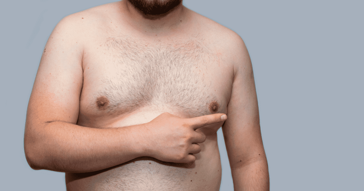 Qué es la ginecomastia: Por qué aparece y cuándo consultar